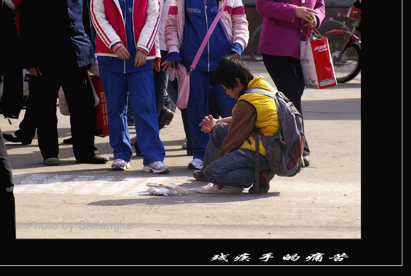 之一：残疾手的痛苦 摄影 石方刻